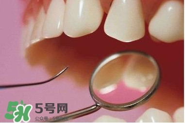 牙周炎傳染嗎？牙周炎會不會傳染