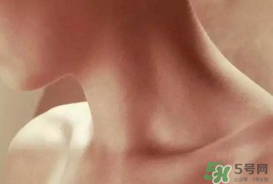 頸椎老化是什么病？頸椎老化的癥狀