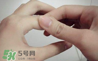痛風(fēng)有什么癥狀？女性痛風(fēng)的初期癥狀