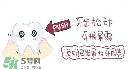 牙齒松動(dòng)能自己恢復(fù)嗎？牙齒松動(dòng)會(huì)自己恢復(fù)嗎