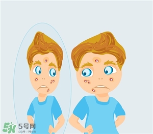 得了痤瘡飲食注意什么？有痤瘡吃東西注意什么