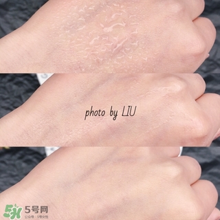 美帕b5噴霧有激素嗎？美帕噴霧副作用