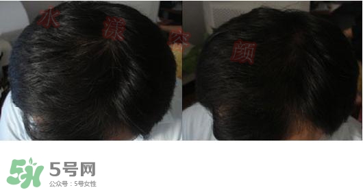  資生堂不老林洗發(fā)水怎么樣？資生堂不老林洗發(fā)水能長頭發(fā)嗎