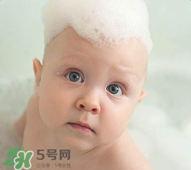 寶寶頭皮上的污垢可以摳掉嗎？寶寶頭上的頭垢該怎么處理？
