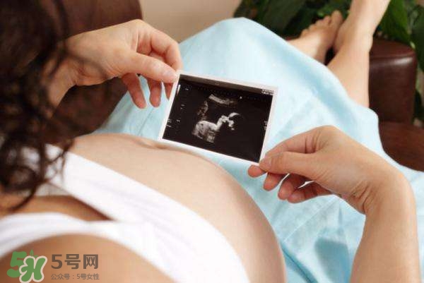 四維彩超能看出男女嗎？四維彩超能看清手指嗎？