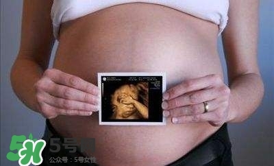 四維彩超能看出男女嗎？四維彩超能看清手指嗎？