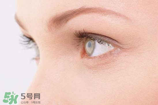 眼睛布滿血絲怎么回事？眼睛布滿血絲怎么辦