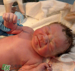 新生兒手握避孕環(huán)出生是怎么回事？出生后健康嗎？