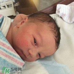 新生兒手握避孕環(huán)出生是怎么回事？出生后健康嗎？