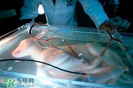 人造子宮能生孩子嗎？人造子宮成功案例