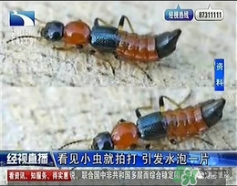 隱翅蟲(chóng)有毒嗎？隱翅蟲(chóng)會(huì)毀容嗎？