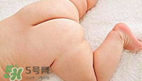 尿布疹怎么辦？寶寶尿布疹擦什么藥好？