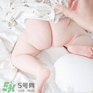 尿布疹和濕疹的區(qū)別 尿布疹和濕疹如何區(qū)分？