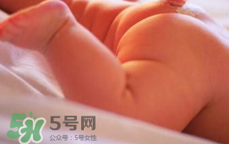 寶寶尿布疹可以擦紅霉素軟膏嗎？紅霉素軟膏對(duì)尿布疹有效嗎？