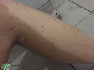 shills舒兒絲去角質雪泡怎么用？shills舒兒絲去角質雪泡用法