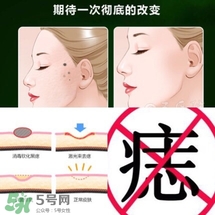 藥水點痣和激光點痣哪個好？各有什么優(yōu)缺點
