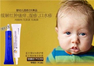 恩姆花園濕疹膏有激素嗎？恩姆花園濕疹膏含不含激素？