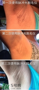 松下es wh93脫毛儀怎么樣？松下es wh93脫毛儀多少錢