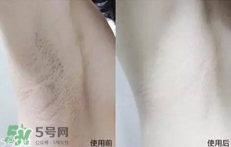 nair脫毛膏評測？nair脫毛膏保質(zhì)期