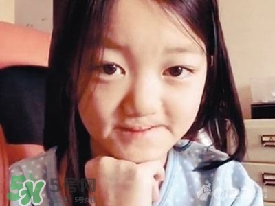 兔唇是什么？兔唇是什么原因造成的？