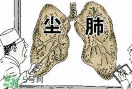 一般幾年時(shí)間會(huì)有塵肺病？塵肺病的早期癥狀