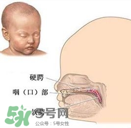 兔唇能檢查出來嗎？兔唇能完全修復(fù)嗎？