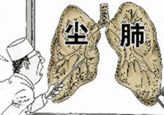 塵肺病能治愈嗎？塵肺病能活多久