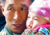 兔唇是什么？兔唇是什么原因造成的？