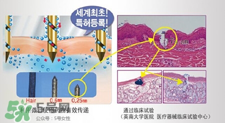 珠兒麗蚊子針好用嗎？珠兒麗蚊子針副作用