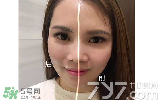 黃金棒有什么用？黃金棒的功效與作用