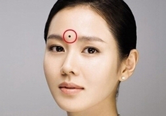 夏天可以點(diǎn)痣嗎？夏天點(diǎn)痣后要注意什么？