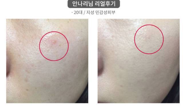 real skin patch怎么樣？real skin是什么牌子