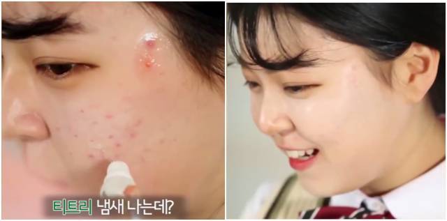 real skin patch怎么樣？real skin是什么牌子