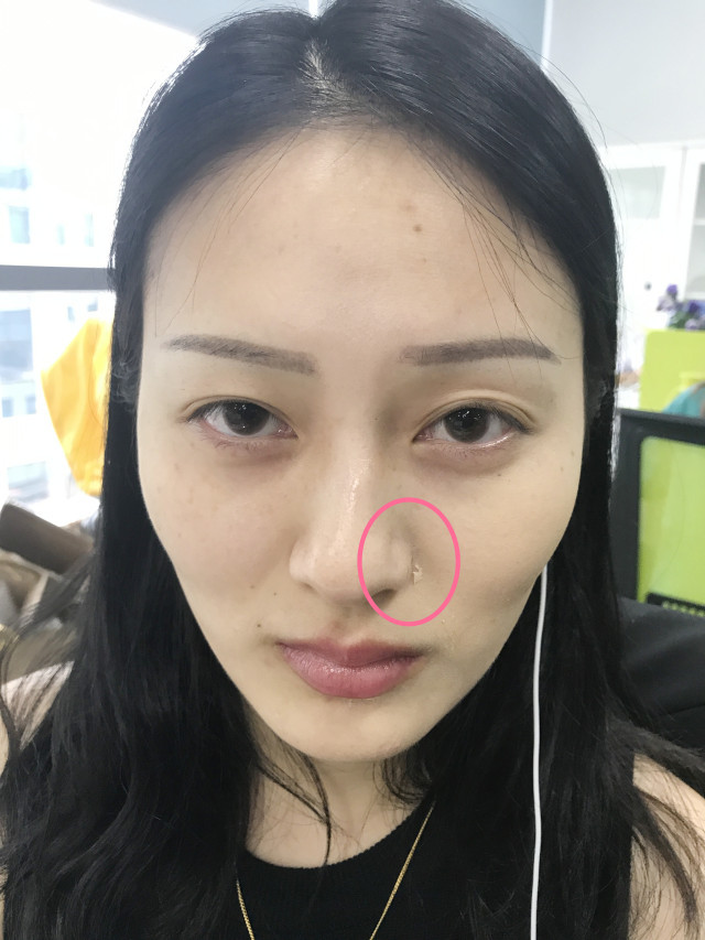 real skin patch怎么樣？real skin是什么牌子