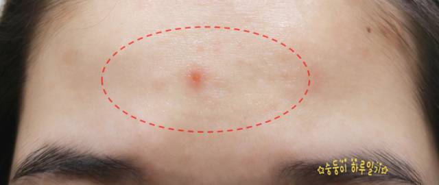 real skin patch怎么樣？real skin是什么牌子