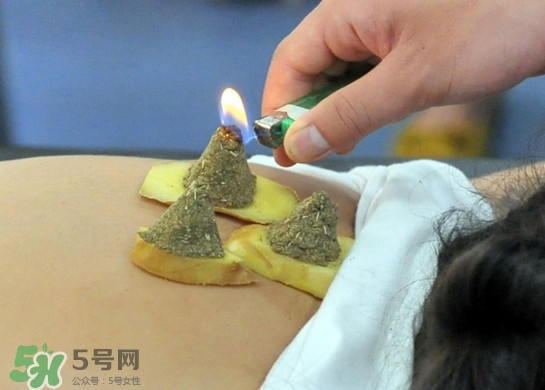 三伏灸灸哪里？三伏灸是每天都灸嗎