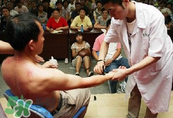刮痧痛嗎？刮痧疼還是拔罐疼