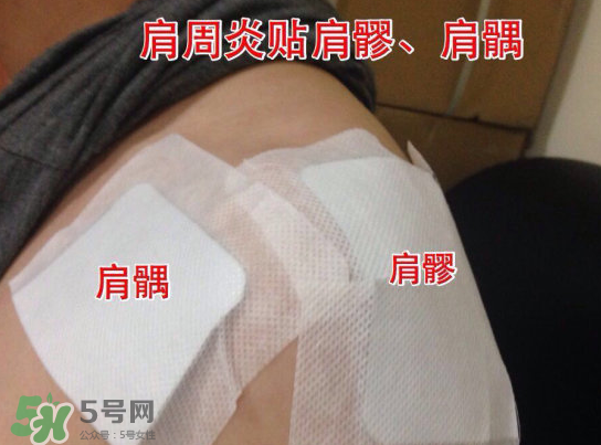 艾灸貼多少錢一盒?？艾灸貼一盒60裝多少錢？