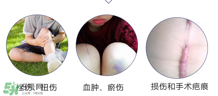hirudoid除疤膏有效嗎？hirudoid去疤膏效果如何？