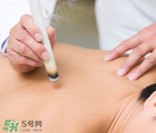 三伏貼和艾灸哪個(gè)好？三伏貼和艾灸區(qū)別