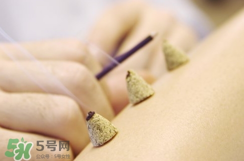 三伏貼和艾灸哪個(gè)好？三伏貼和艾灸區(qū)別