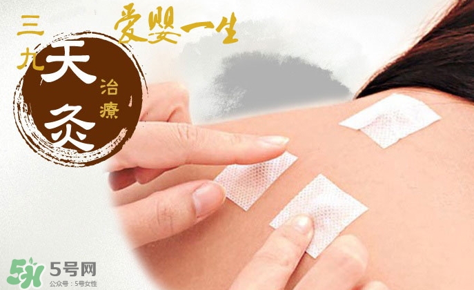 貼三伏貼可以吃魚嗎？貼三伏貼可以吃什么魚？