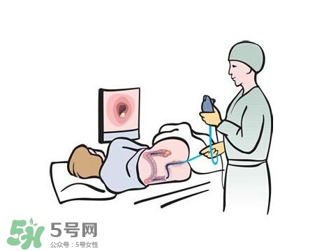 直腸癌怎么查出來(lái)的？直腸癌怎么判斷早晚期