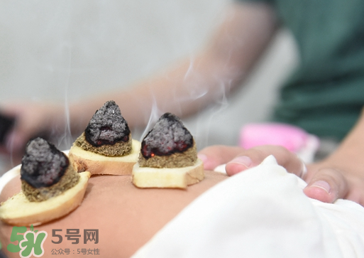 三伏灸什么人不能做？三伏灸適合哪些人？