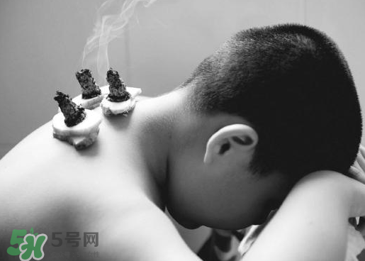 三伏灸什么人不能做？三伏灸適合哪些人？