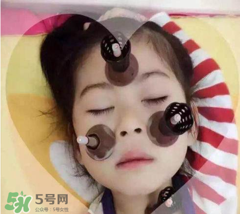 艾灸貼可以治咳嗽嗎？艾灸貼可以治退燒嗎？