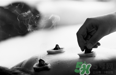 三伏灸什么時(shí)候開(kāi)始灸？三伏灸怎么灸？