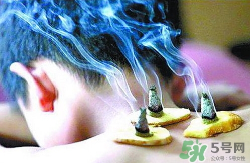 三伏灸什么時(shí)候開(kāi)始灸？三伏灸怎么灸？