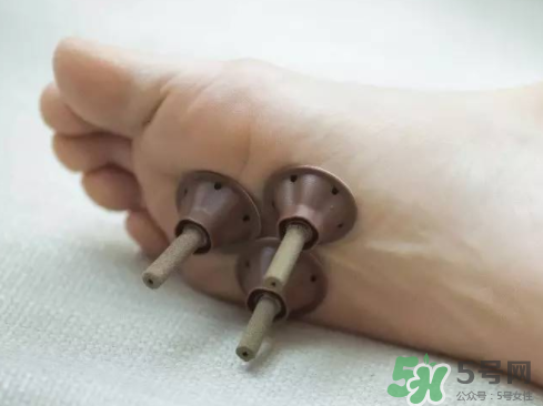 艾艾貼灸出水珠為什么？艾艾貼后有水珠要擦嗎？