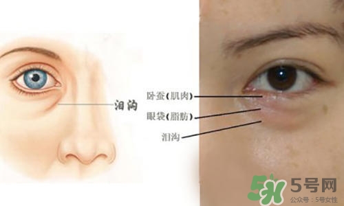 淚溝能自己恢復(fù)嗎？淚溝怎么自己恢復(fù)？